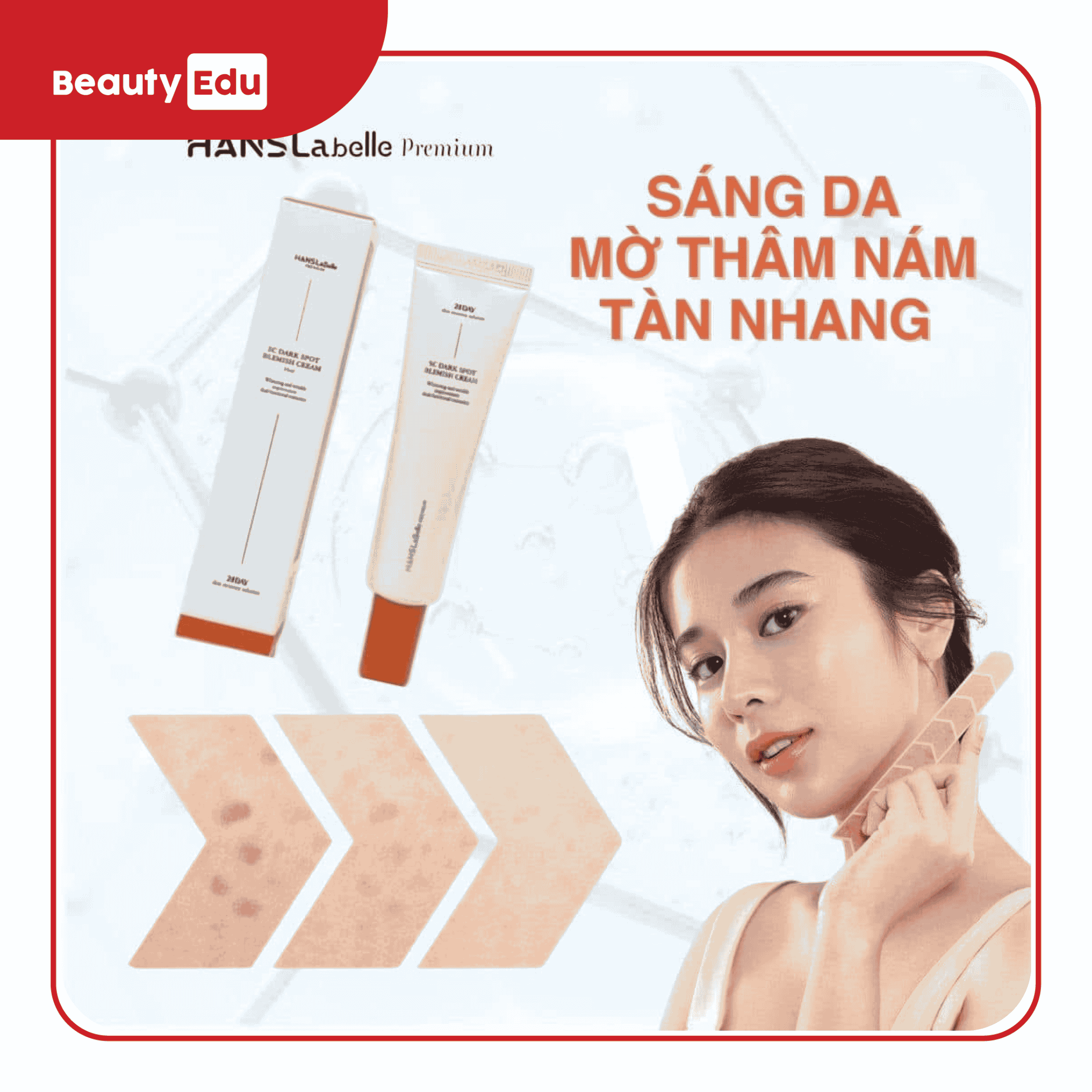 Kem trị nám sắc tố tàn nhang Hanslabelle