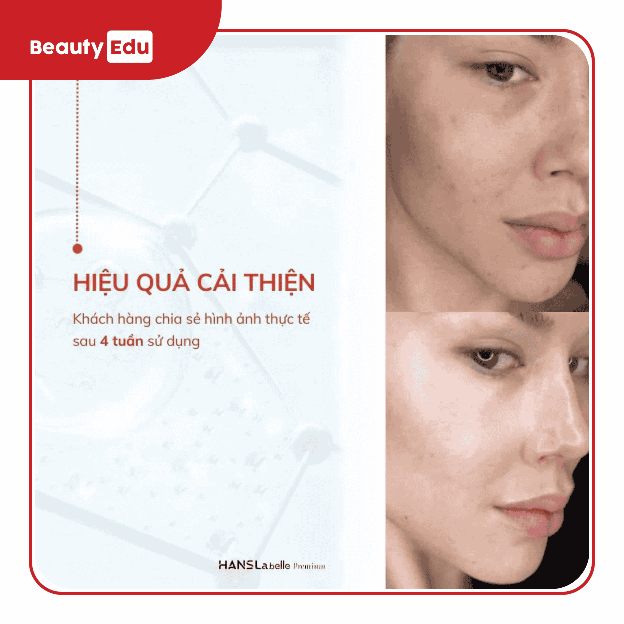 Kem trẻ hóa da Retinal Hanslabelle